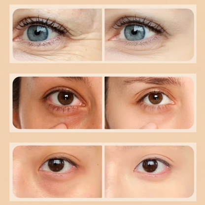 Precision Red Light Therapy Pen